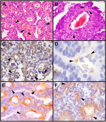 Decidual cells and decidualization in the carnivoran endotheliochorial placenta